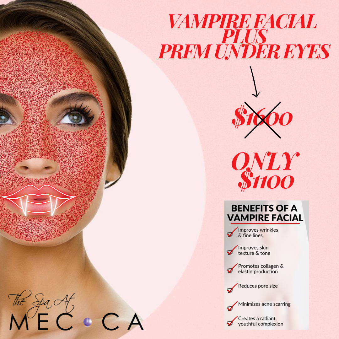 vampire facial face & tear trough