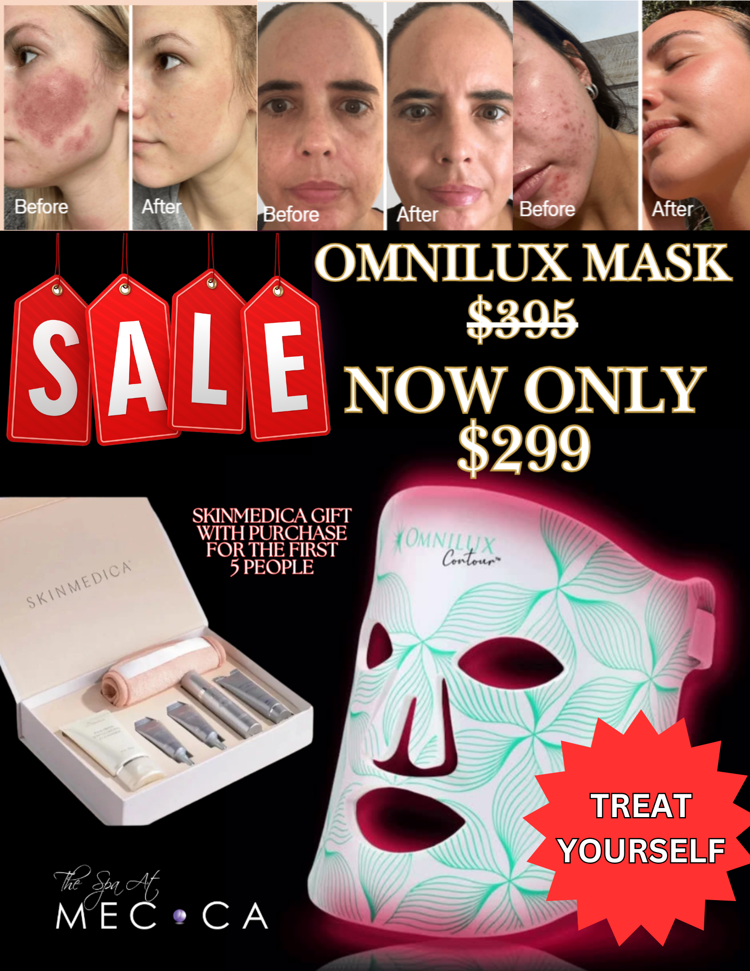 TREAT YOURSELF